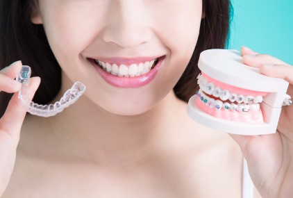 Invisalign Benefits, Surrey Dentist